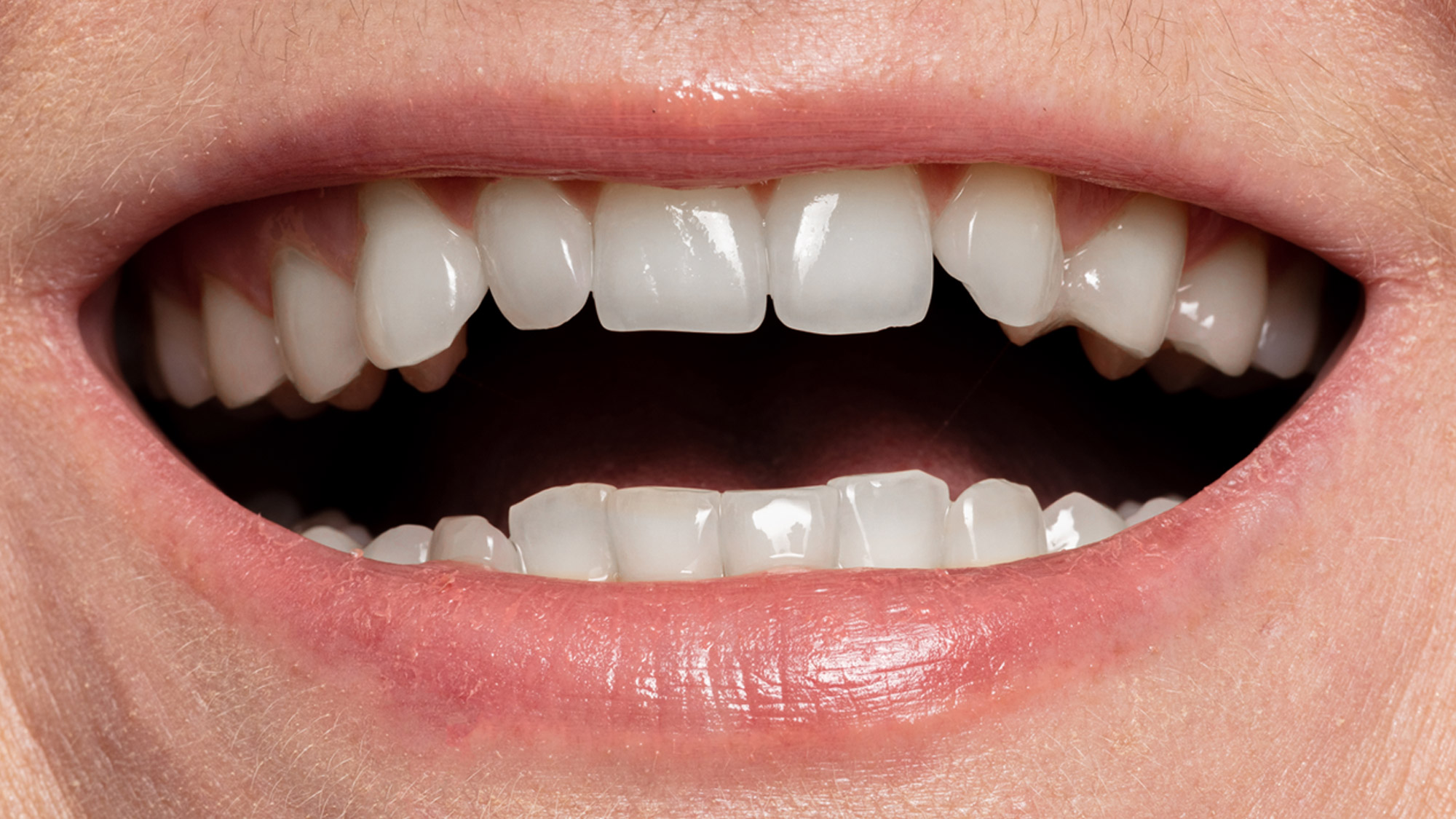 Dental Technology